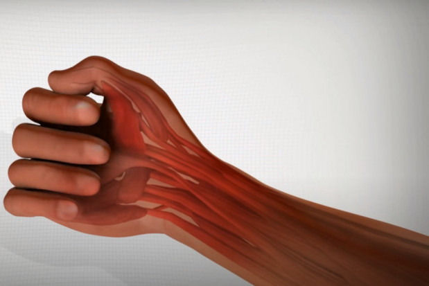 Rękawice ochronne dla stomatologa na bóle rąk?