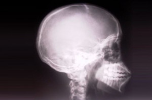 Szkolenia w zakresie rtg Punkty za szkolenia w zakresie ochrony radiologicznej: ile, kiedy i za co