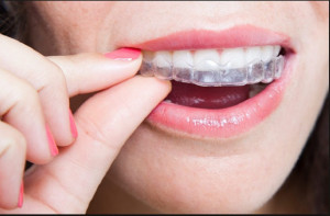 Nowe metody leczenia zgryzu mogą być konsultowane zdalnie (fot. Archiwum) Finansowe realia pracy dentysty w pandemii