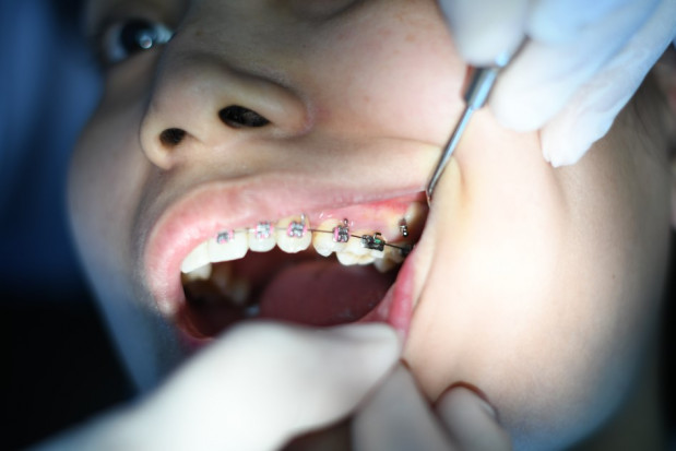 Dentysta w czasie pandemii (fot. unsplash) Koronawirus a częstotliwość wizyt u dentysty