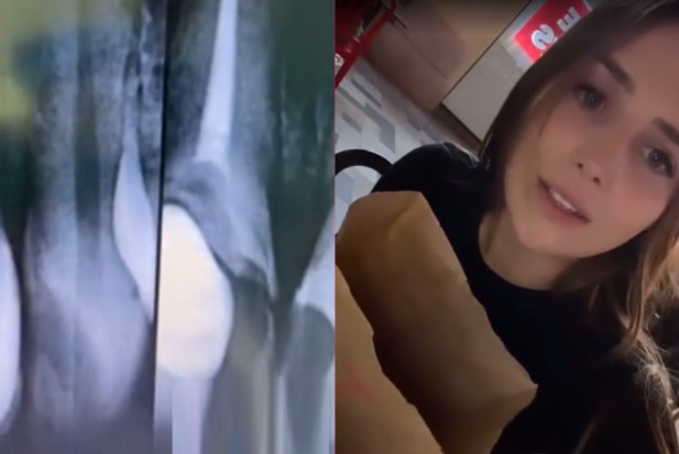 Kłopoty zdrowotne Oli Nowak (fot. Instagram) Złamana jedynka sprawą ogólnopolską