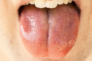 Naukowcy opracowują szybki i tani test, który wykrywa koronawirusa w ślinie (fot. pixabay) U dentysty testy ze śliny na koronawirusa