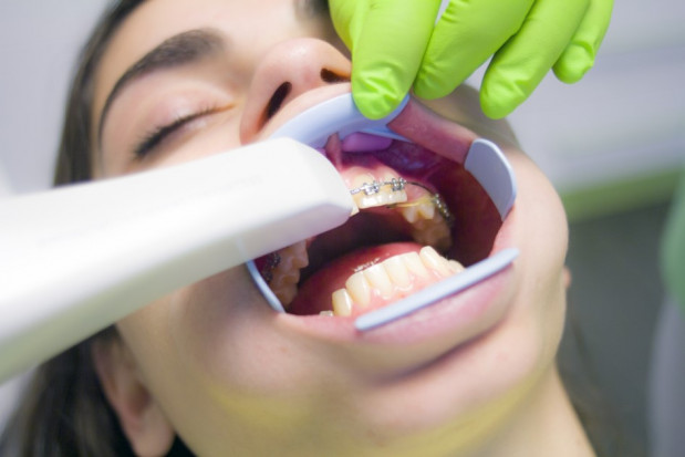 Wysoki odsetek dentystów zakażonych COVID-19