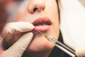 Zabiegi medycyny estetycznej, przez kogo (fot. unsplash) Postulat: zabiegi medycyny estetycznej w gestii wyłącznie lekarzy i lekarzy dentystów