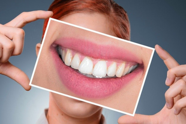 (fot. Pixabay) Dentystka funduje nowy uśmiech wart 10 tys. dolarów