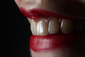 Polacy chcą poprawić stan uzębienia (fot. unsplash) Medicover Stomatologia: co trzeci pacjent zamierza poprawić wygląd swoich zębów