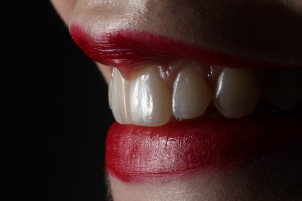 Medicover Stomatologia: co trzeci pacjent zamierza poprawić wygląd swoich zębów