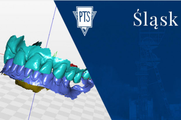 Śląski PTS organizuje webinar ze stomatologii cyfrowej