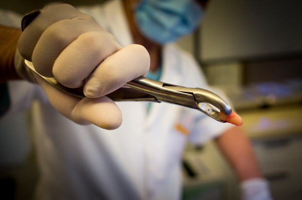 NHS: usunięcie niewłaściwego zęba nie będzie zdarzeniem niepożądanym