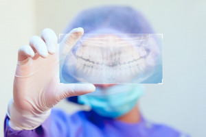 Akcja profilaktyczna dentystów z woj. zachodniopomorskiego