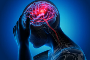 Udar obciążeniem przy CVID-19 (fot. shutterstock) COVID-19: groźniejszy udar niż niewydolność krążenia