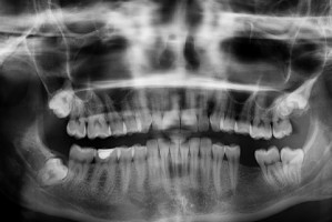 Krajowa Baza Urządzeń Radiologicznych po konsultacjach