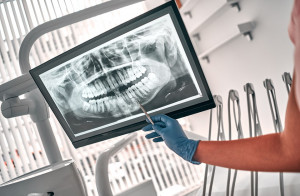 Urządzenie radiologiczne w gabinecie stomatologicznym