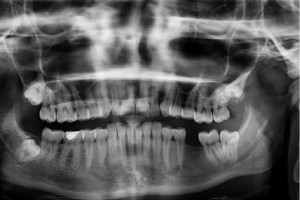 NRL o szkoleniach dla inspektorów ochrony radiologicznej