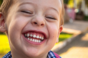 Niemal 25 proc. dzieci w wieku 5-6 lat nie było jeszcze u dentysty (fot. Unsplash) Pantomogram próchnicy z okazji Dnia Dziecka