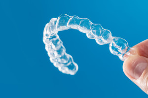 Alignery nabierają tempa (fot. shutterstock) Nowa generacja żywic do produkcji alignerów