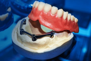 Zortrax Dental puka do drzwi lecznic stomatologicznych