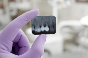 Konkurs ofert na leczenie stomatologiczne (fot. shutterstock) Podkarpackie: konkurs ofert na leczenie stomatologiczne