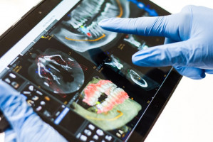 Fot. Ile kosztuje implant zęba? Poznaj aktualne ceny (mat.pras.) Ile kosztuje implant zęba? Poznaj aktualne ceny