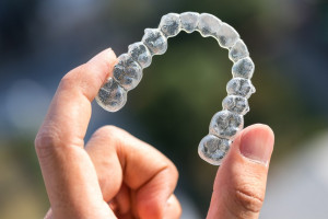 Systemem Invisalign to już codzienność (fot. shutterstock) System Invisalign pod lupą: koszty, leczenie, współpraca z pacjentem