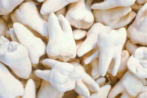Wskazania do ekstrakcji zęba (fot. pixabay) Nadgorliwość w usuwaniu zębów w chorobach przyzębia