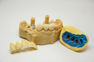 UMB zaprasza higienistki stomatologiczne i techników dentystycznych (fot. unsplash) UMB: limity przyjęć na techniki dentystyczne i higienę stomatologiczną