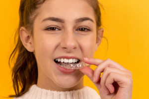 Mity na temat wybielania zębów wiecznie żywe