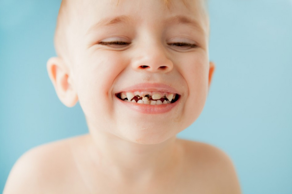 Błędy żywieniowe wczesnego dzieciństwa pokutują długo złym stanem zębów (fot. stock.adobe.com)