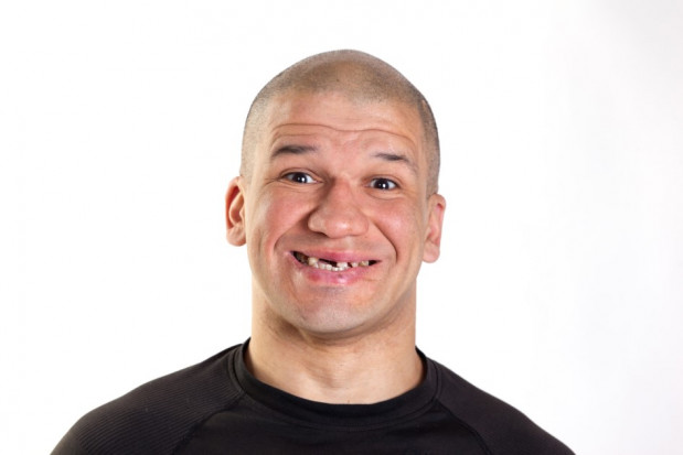 Bez zębów nie obędzie się bez problemów (fot. adobe) Braki w uzębieniu to piramida problemów!