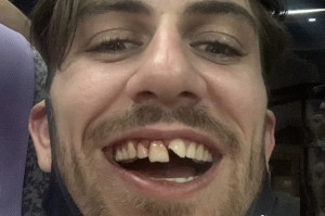 Tyczkarz igrzyska olimpijskie w Tokio zaczyna od dentysty