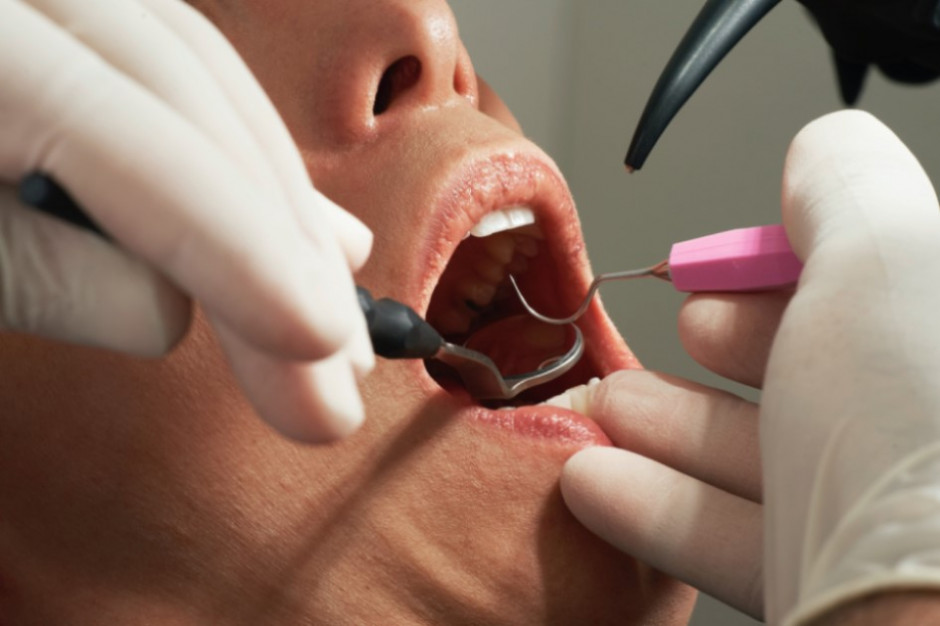 Wyceny zabiegów periodontologicznych wg aktualnego projektu NFZ, zależą od tego, jaki specjalista je wykonuje (fot. Unsplash)