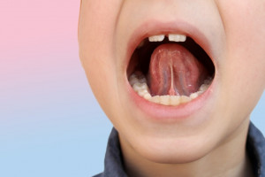 Od logopedy do dentysty (fot. shutterstock) Logopeda - partnerem lekarza dentysty