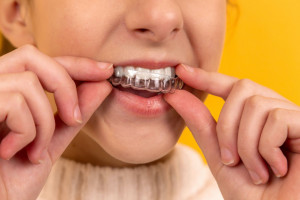 Co pacjent powinien wiedzieć w trakcie leczenia ortodontycznego