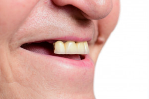 FDI poszukuje ekspertów zajmujących się zdrowiem jamy ustnej
