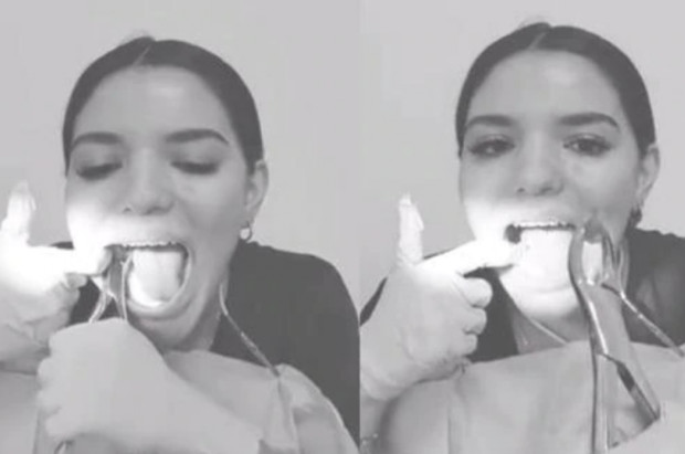Dentystka usuwa sobie ząb i dzieli się tym wydarzeniem na TT W jaki sposób dentysta może zdobyć wielkie zasięgi na Twitterze
