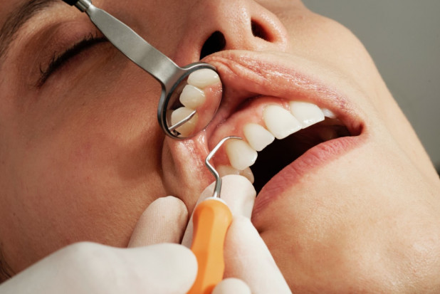 Dlaczego pacjent zmienia dentystę
