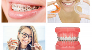 Na co postawić w leczeniu ortodontycznym