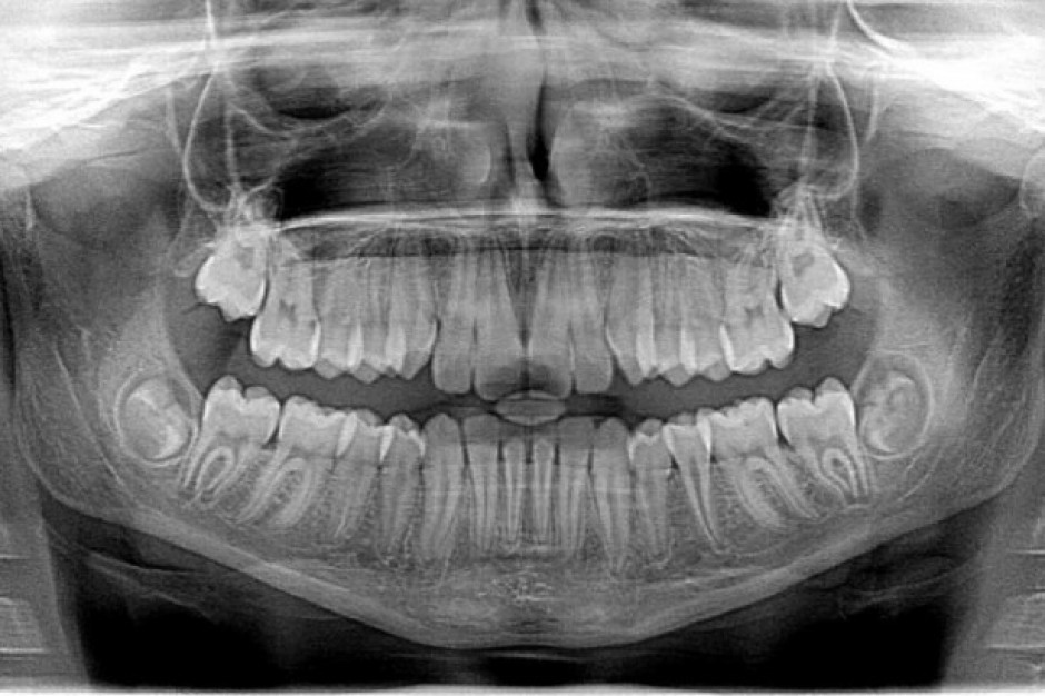 Aparatura rtg w stomatologii (fot. Pixabay)