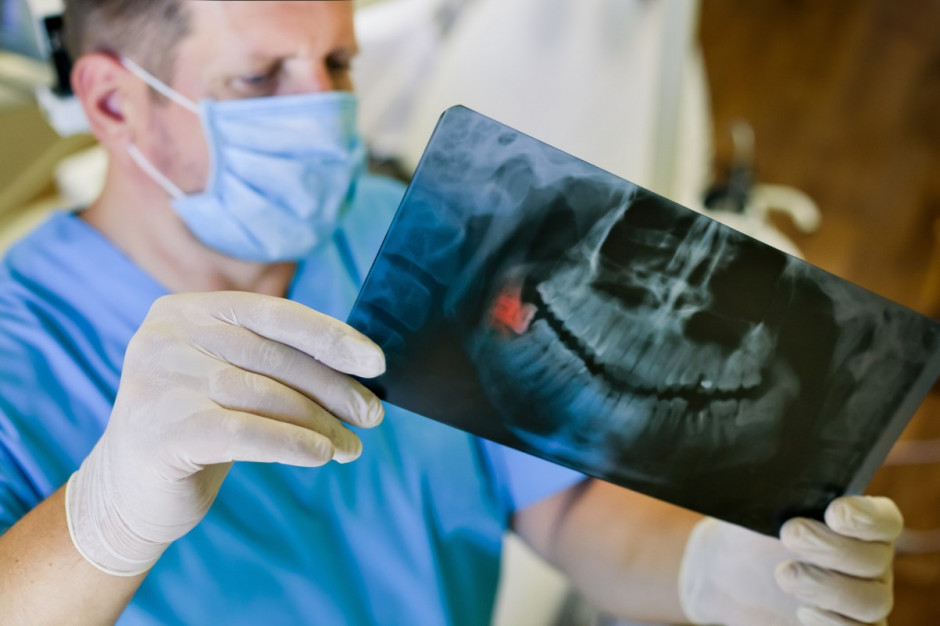 Wykonywanie zdjęć pantomograficznych podlega nowym regulacjom (fot. Shutterstock) Wykonywanie zdjęć pantomograficznych podlega nowym regulacjom (fot. Shutterstock)