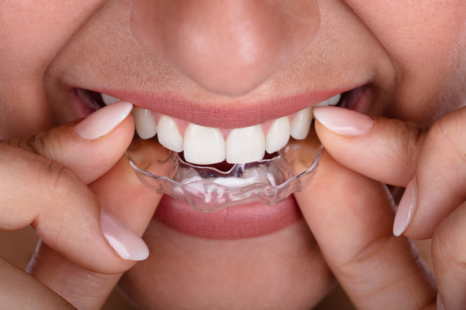 Wybielanie zębów i nakładki ortodontyczne (fot. Shutterstock)