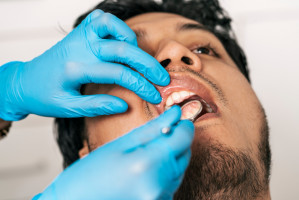 Co czwarty Brytyjczyk nie był u dentysty w ostatnim roku (fot. Shutterstock) Koronawirus: skrajne postawy pacjentów