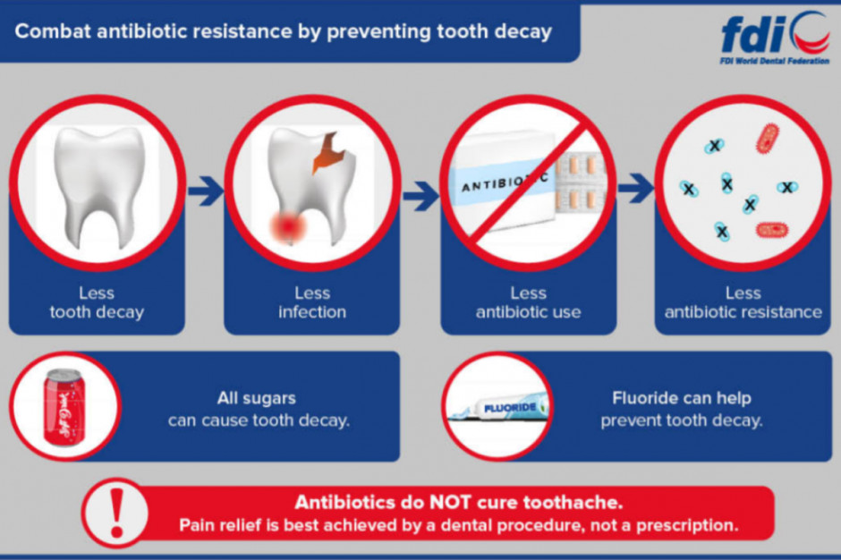 Zapobieganie antybiotykooporności w gabinecie dentystycznym (fot. CED)