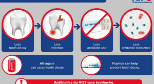 CED: dentyści ograniczajcie ordynowanie antybiotyków!