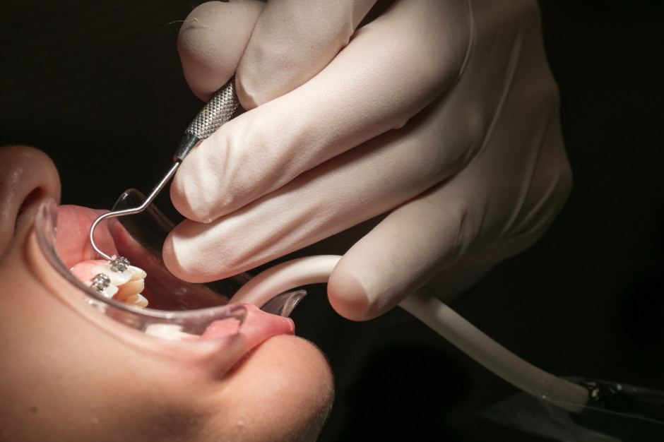 Kolejki do ortodonty  (fot. Shutterstock)