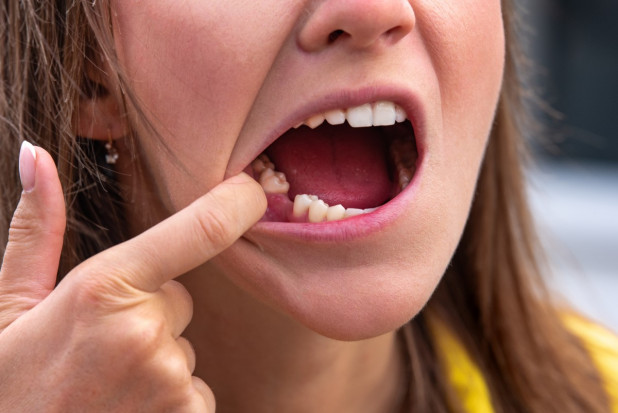 Coraz gorszy dostęp do dentysty (fot. Unsplash) Bezzębni się jednoczą