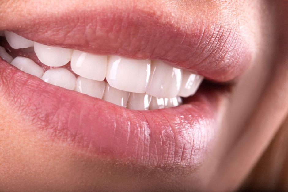 Kupowanie środków wybielających zęby przez internet nie jest bezpieczne (fot. Shutterstock)