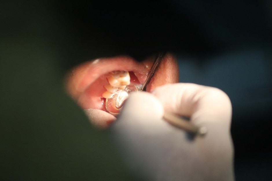 Lepsze i tańsze materiały stomatologiczne do leczenia próchnicy (fot. Unsplash)