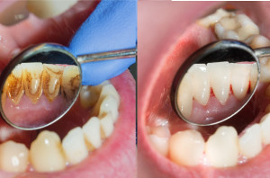 Dynamika cen usług stomatologicznych (fot. Shutterstock) GUS: ceny usług stomatologicznych w górę