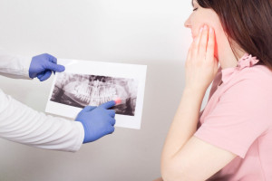 Zęby mądrości mogą sprawiać wiele problemów (fot. Shutterstock) Wyrzynające się ósemki bolą bo...