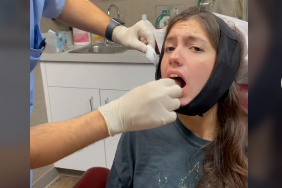Pacjentka próbowała przekonać dentystę do swojej ulubionej piosenkarki (fot. TikTok)